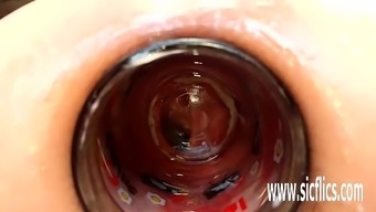 Extreme Anal Fisting And Bizarre Insertions