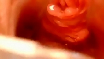Pussy Close Up And Speculum